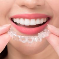 Invisalign