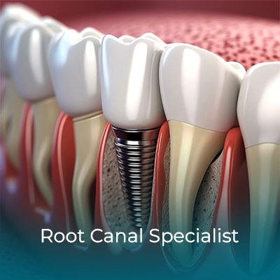 Root Canal Specialist