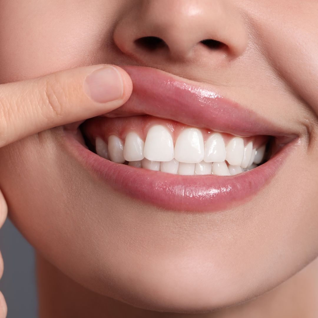Why Dental Hygiene Matters More Than You Think     
