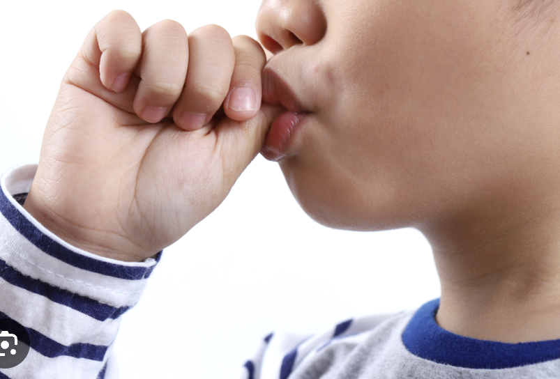 Thumb Sucking in Children